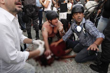 Santiago Andrade foi atingido por um rojão durante protesto Santiago Andrade foi atingido por um rojão durante protesto
