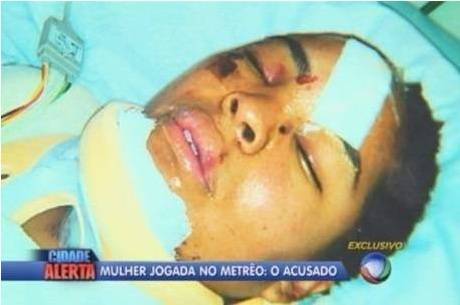 Maria da Conceição Oliveira, de 28 anos, perdeu um braço e lesionou a coluna ao ser jogada nos trilhos do metrô