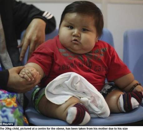 Com 8 Meses Bebe Colombiano Chega Aos Kg Por Culpa De Mae Se Ele Chorava Eu Oferecia Comida Fotos R7 Saude