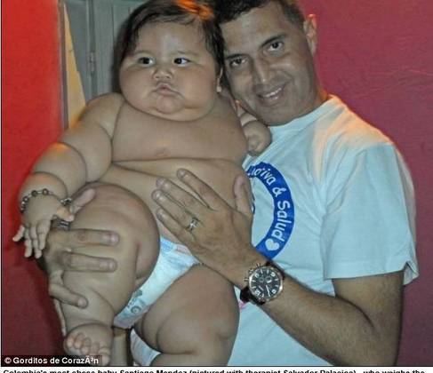 Com 8 Meses Bebe Colombiano Chega Aos Kg Por Culpa De Mae Se Ele Chorava Eu Oferecia Comida Fotos R7 Saude