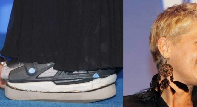 Pé de Xuxa com bota ortopédica e curativo Pé de Xuxa com bota ortopédica e curativo