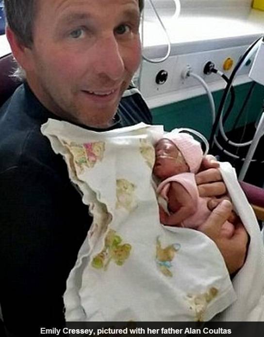 Emocionante Bebe De 500 Gr Agarra Mao Da Propria Mae Em Batalha Pela Vida Fotos R7 Saude Emocionante Bebe De 500 Gr Agarra Mao Da Propria Mae Em Batalha Pela Vida Fotos R7 Saude
