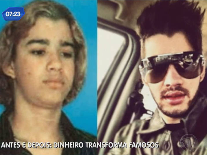 Antes e depois: dinheiro transforma famosos - Fotos - R7 Balanço Geral