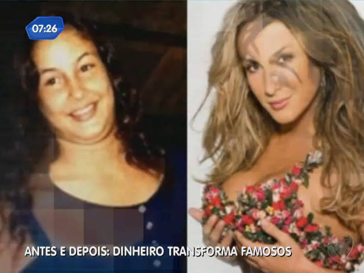 Antes e depois: dinheiro transforma famosos - Fotos - R7 Balanço Geral