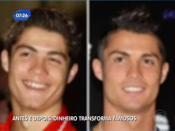 Antes e depois: dinheiro transforma famosos - Fotos - R7 Balanço Geral