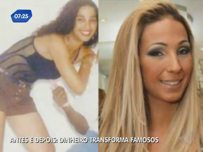 Antes e depois: dinheiro transforma famosos - Fotos - R7 Balanço Geral