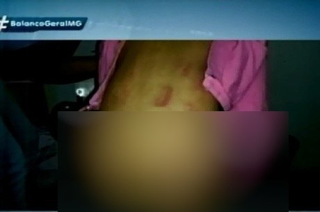 Foto da menina agredida foi entregue à polícia