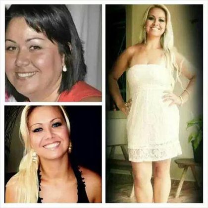 Antes e depois: dinheiro transforma famosos - Fotos - R7 Balanço Geral