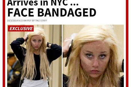 Amanda Bynes E Flagrada Com Curativo Grande No Rosto E Pessoas Proximas Dizem Que Ela Vive Drogada Entretenimento R7 Pop