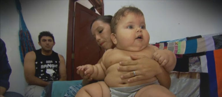 "Bebê gigante" do Nordeste pesa 19Kg com apenas um ano de idade