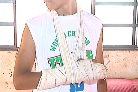 Estudante teve dedos quebrados durante agressão em escola da rede municipal de ensino