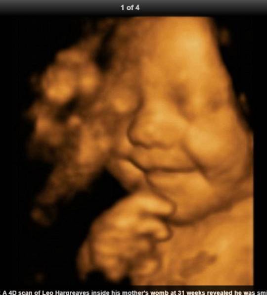 No Flagra Bebe Mais Feliz Do Mundo Aparece Sorrindo Na Barriga Da Mae Em Ultrassom Confira Fotos R7 R7 Meu Estilo