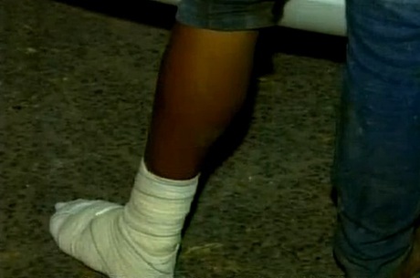 Adolescente quebrou um pé e um braço durante a fuga