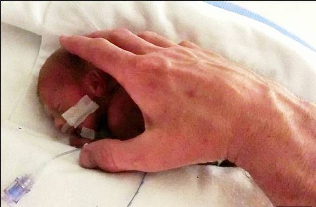 Emocionante Bebe Com Sentenca De Morte Nasce Com 600g E Sobrevive Fotos R7 Saude
