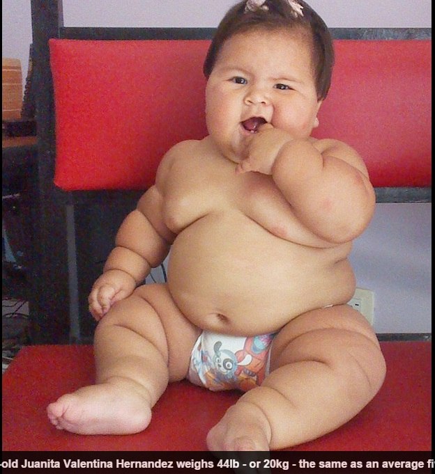 Bebe De 10 Meses Pesa kg E Chama Atencao De Medicos Na Colombia Fotos R7 Saude