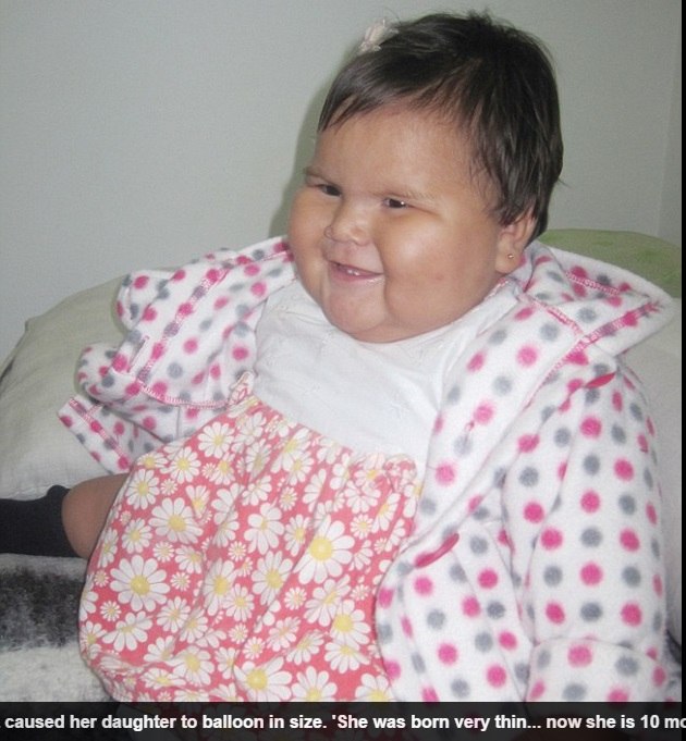 Bebe De 10 Meses Pesa kg E Chama Atencao De Medicos Na Colombia Fotos R7 Saude