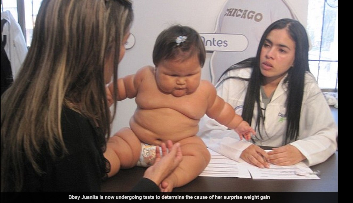 Bebe De 10 Meses Pesa kg E Chama Atencao De Medicos Na Colombia Fotos R7 Saude