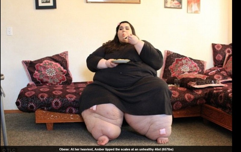 obesos morbidos fotos