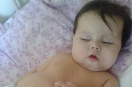 Sofia se recupera de transplante de cinco órgãos em Miami