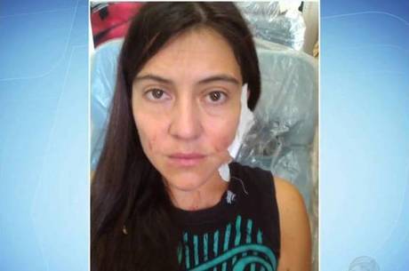 Isidora R. Carmona, de 32 anos, foi ferida no rosto e no pescoço
