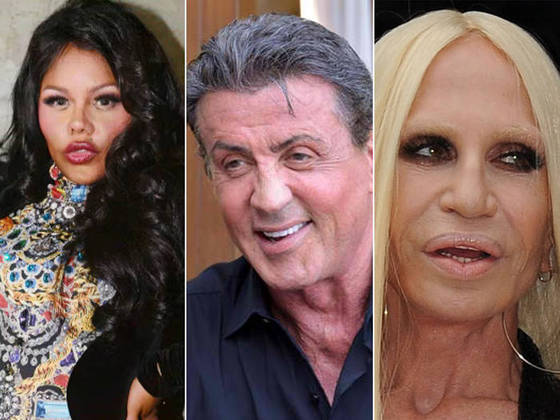 O que aconteceu? Confira a transformação de Donatella Versace ao longo dos  anos - R7 Meu Estilo - R7 R7 Meu Estilo