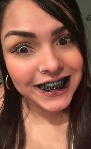Mulher Melancia Assusta Fas Com Dentes Podres Entretenimento R7 Famosos E Tv Elementos dentais isométricos com dentes doentes e saudáveis, implantes de pasta de dentes raspador de escova de dentes, fio dental isolado. mulher melancia assusta fas com dentes