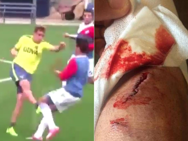 Relembre lesões assustadoras que chocaram o mundo do esporte - Estadão