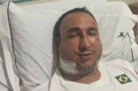 Fotos tiradas por familiares mostram como o presidente da federação ficou após a agressão Fotos tiradas por familiares mostram como o presidente da federação ficou após a agressão