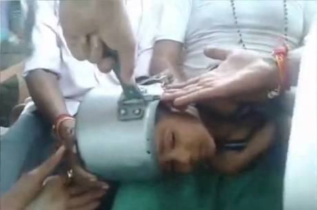 As imagens capturadas em um telefone celular mostram o momento em que a panela está sendo cortada por cima da cabeça do menino
