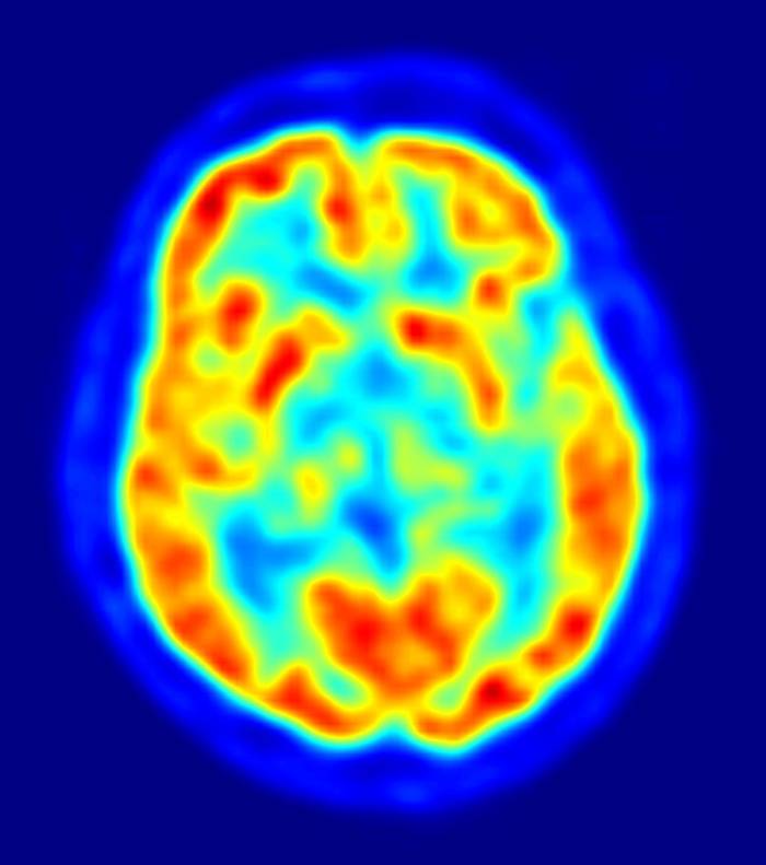 Cientistas encontram'espírito natalino' no cérebro Notícias R7 Tecnologia e Ci u00eancia Adesivo De Parede Quarto Infantil ~ Cientistas encontram'espírito natalino' no cérebro Notícias R7 Tecnologia e Ci u00eancia