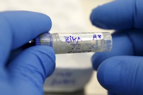 Técnico de saúde analisa amostra de sangue de paciente com Zika em Lima
