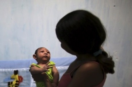 Pernambuco tem 1.501 notificações de bebês com suspeita de microcefalia desde o agravamento da epidemia de zika