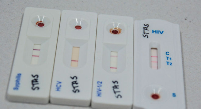 Os testes rápidos para HIV fornecem o resultado em 30 minutos