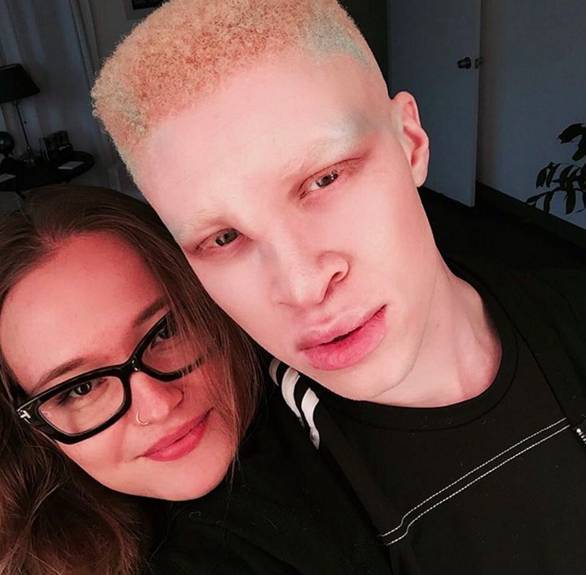 Entre o preconceito e a passarela: conheça os modelos albinos que estão  fazendo sucesso no mundo inteiro - Fotos - R7 Internacional