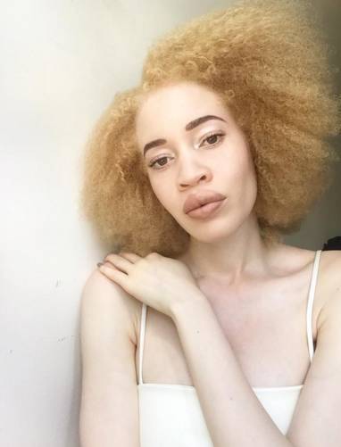 Entre o preconceito e a passarela: conheça os modelos albinos que estão  fazendo sucesso no mundo inteiro - Fotos - R7 Internacional