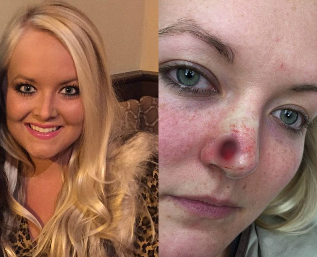 Jovem desenvolve câncer e fica com