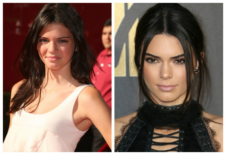 Veja como eram as Kardashian antes e depois das cirurgias plásticas Fotos R7 R7 Meu Estilo