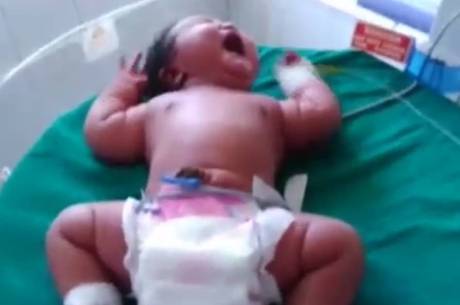 Jovem dá à luz maior bebê do mundo com 6,8 kg - Notícias - R7 Saúde