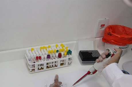 A expectativa do Instituto Butantan é que a vacina possa estar disponível para os primeiros testes em humanos no primeiro semestre de 2017