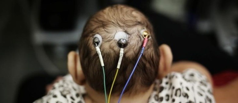 Bebê de 5 meses com microcefalia passa por exames em São Paulo

