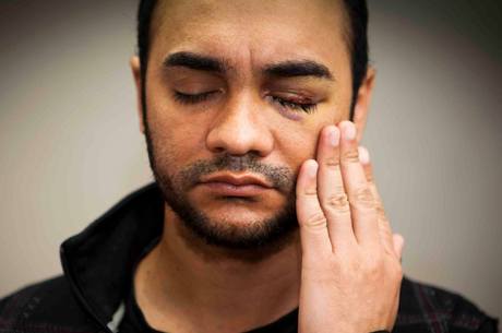 Sérgio Silva perdeu a visão de um olho depois de ser atingido