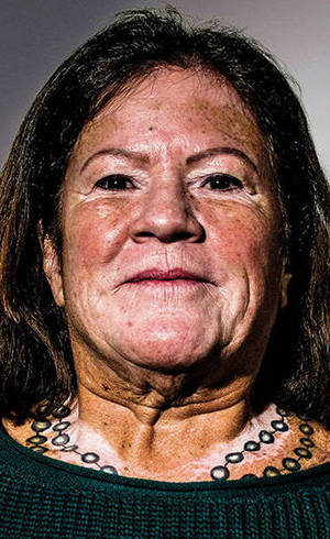 Índia tem vitiligo, aos 60 anos Índia tem vitiligo, aos 60 anos