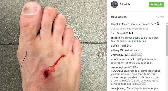 Filipe Luís leva pisão de atacante do Barcelona e mostra ...