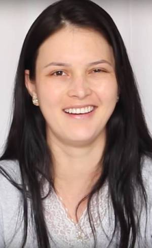 Julia Doorman sofreu paralisia de Bell uma semana após o nascimento da filha Julia Doorman sofreu paralisia de Bell uma semana após o nascimento da filha
