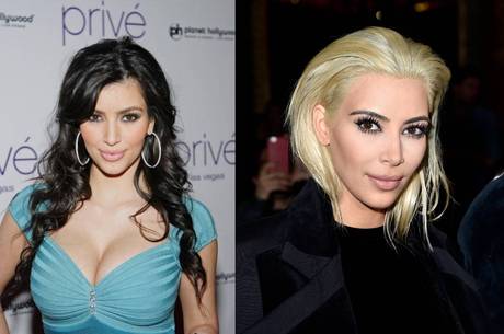 A empresária Kim Kardashian antes e depois da bichectomia 