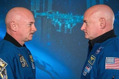 Mudanças são similares às de uma pessoa com estresse na Terra Reprodução/Nasa