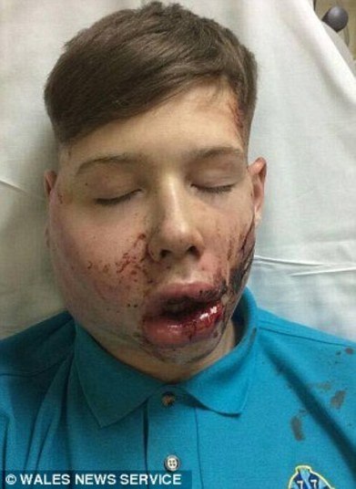 Um menino de 15 anos foi violentamente atacado depois de ter saltado do ônibus, quando caminhava até a escola. O bullying ocorreu em Bridgend, no sul do País de Gales