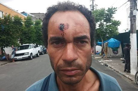 "Davi matou Golias com uma pedra a menos de 30 metros de distância", diz Alexandre de Oliveira Santos. Usuário que mora na cracolândia, ele quer saber se a bala de borracha que recebeu da polícia militar seria capaz de matá-lo "Davi matou Golias com uma pedra a menos de 30 metros de distância", diz Alexandre de Oliveira Santos. Usuário que mora na cracolândia, ele quer saber se a bala de borracha que recebeu da polícia militar seria capaz de matá-lo