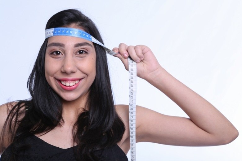 Ana Victória Lago, de 17 anos, tem microcefalia. Ela lutou contra as dificuldades impostas pela doença e tornou-se modelo