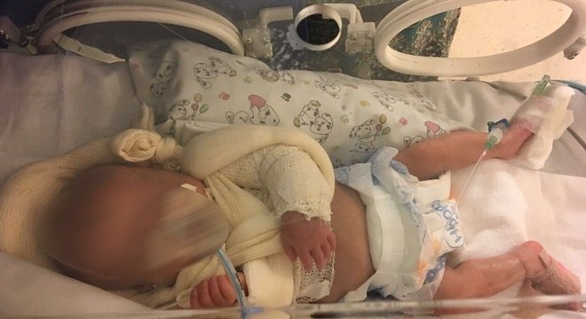 Menina nasceu prematura e segue internada em hospital